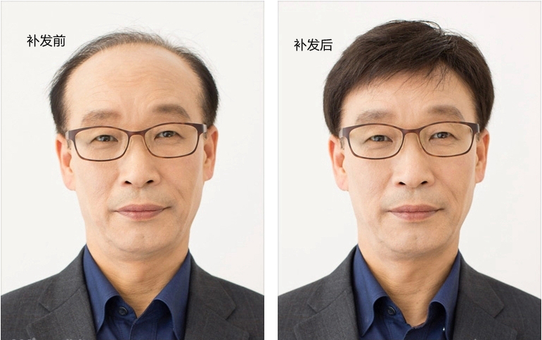 速美假发老总(2)